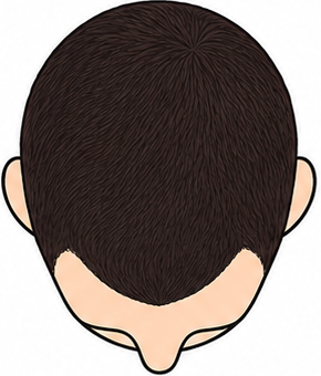 Stage 1